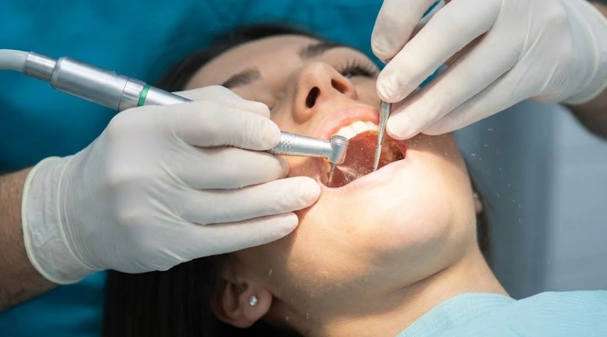 procedura di contorno dentale professionale sicura