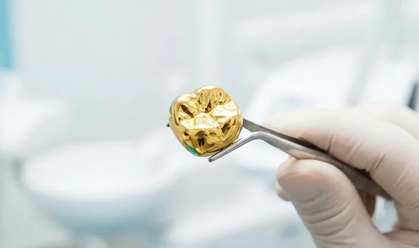 Højt Nobel guldkrone med varig glans