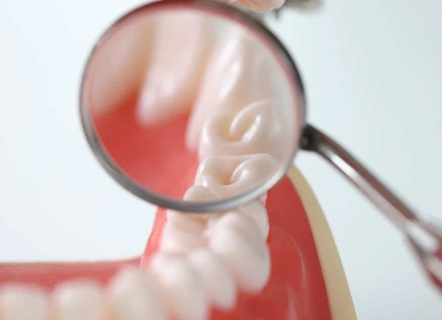 d2150-dental-code-description