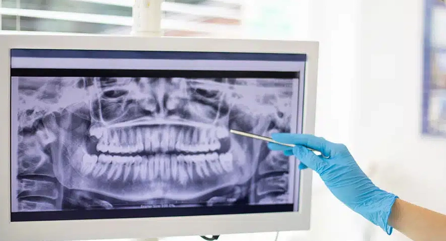 c&oacute;digo-dental-d0330