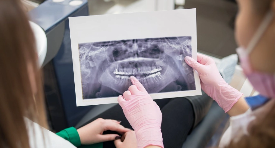 c&oacute;digo-dental-d0330