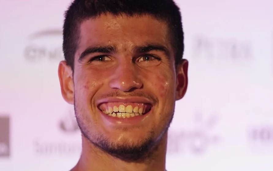 carlos-alcaraz-teeth-in-2015