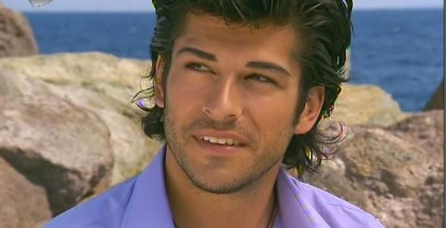 burak özçivit teeth 2000