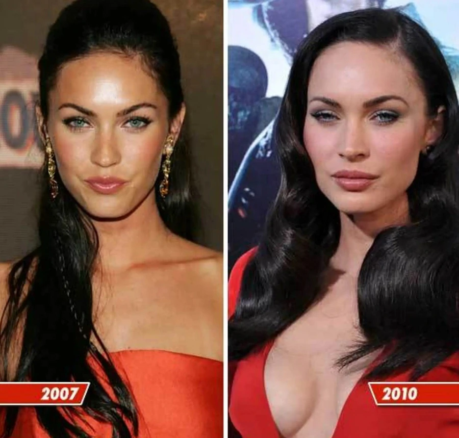 megan fox dopo intervento impianto mammario 2010