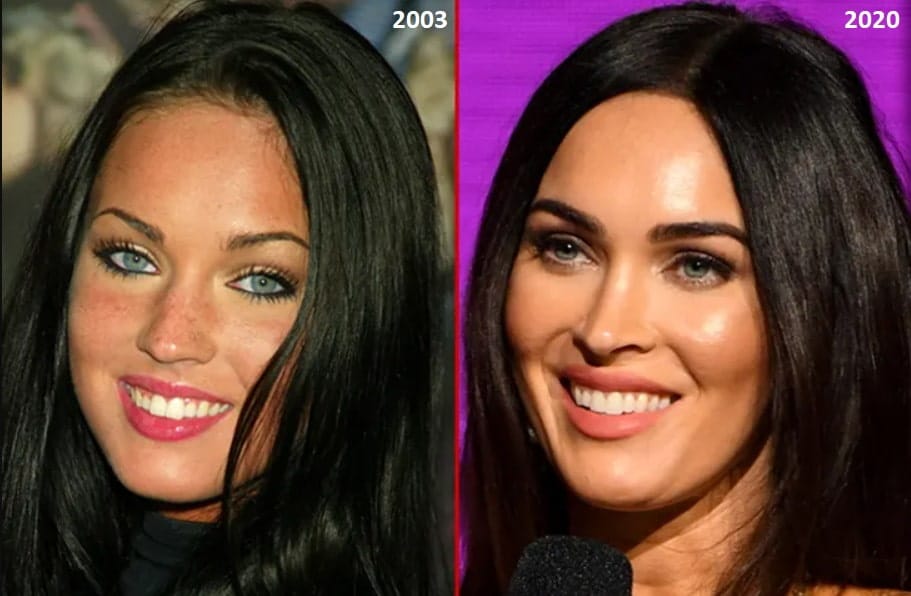 dinții lui megan fox în 2003