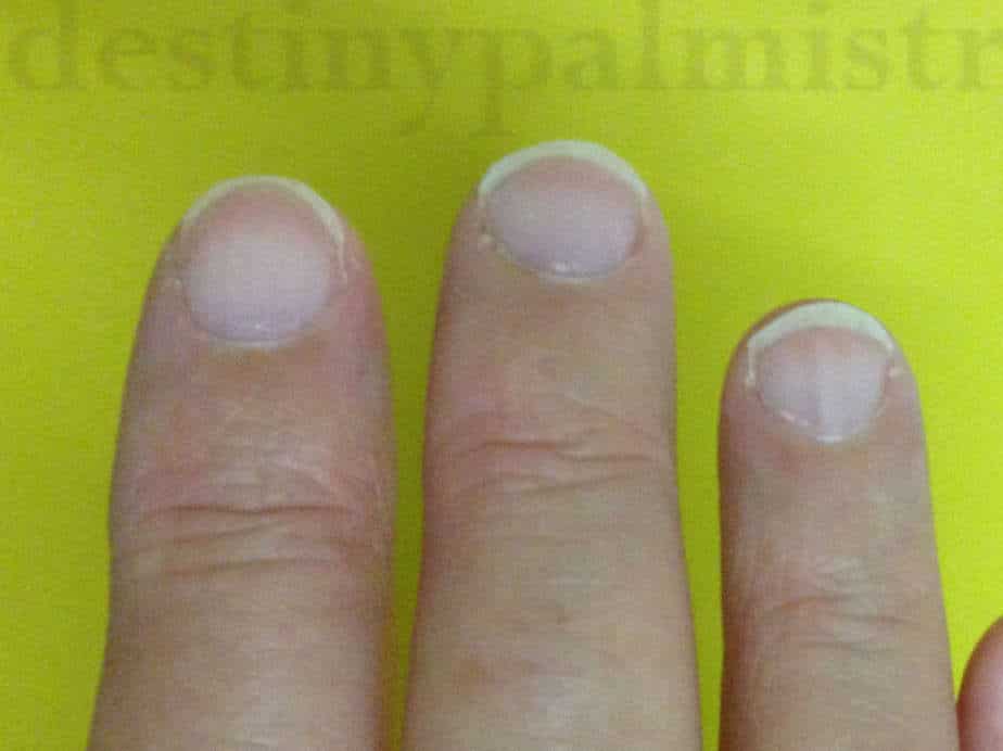 health signs from fingernail, white fingernails, white nails meaning, is white nail bad?