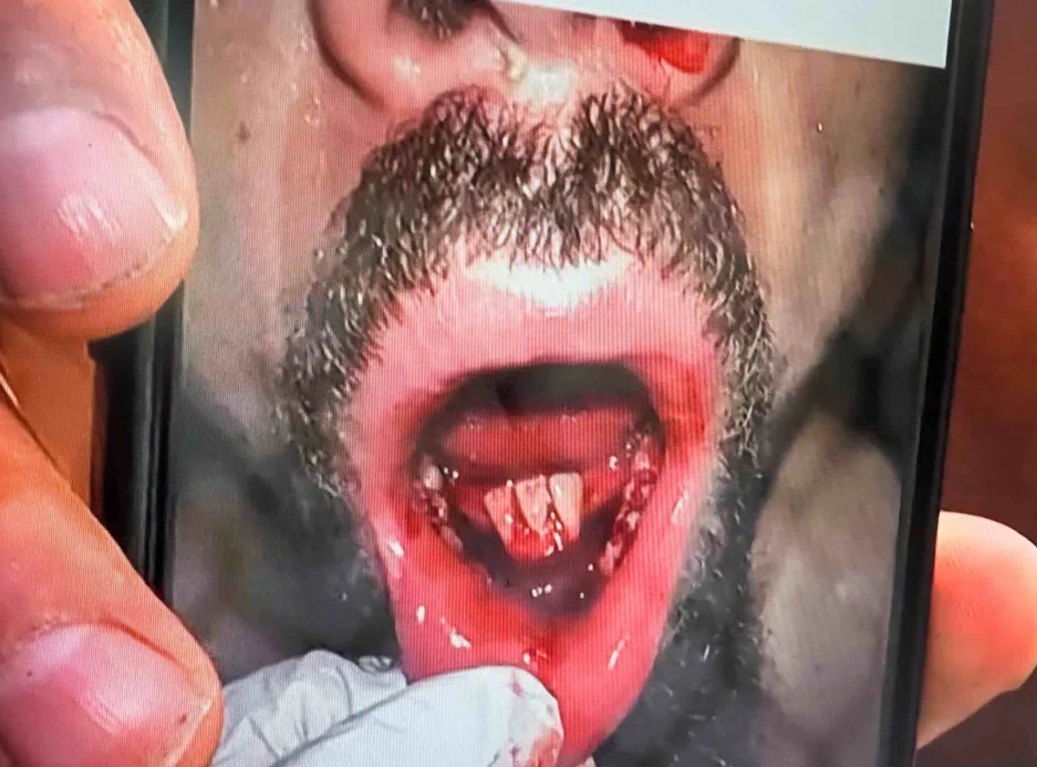 robert whittaker teeth