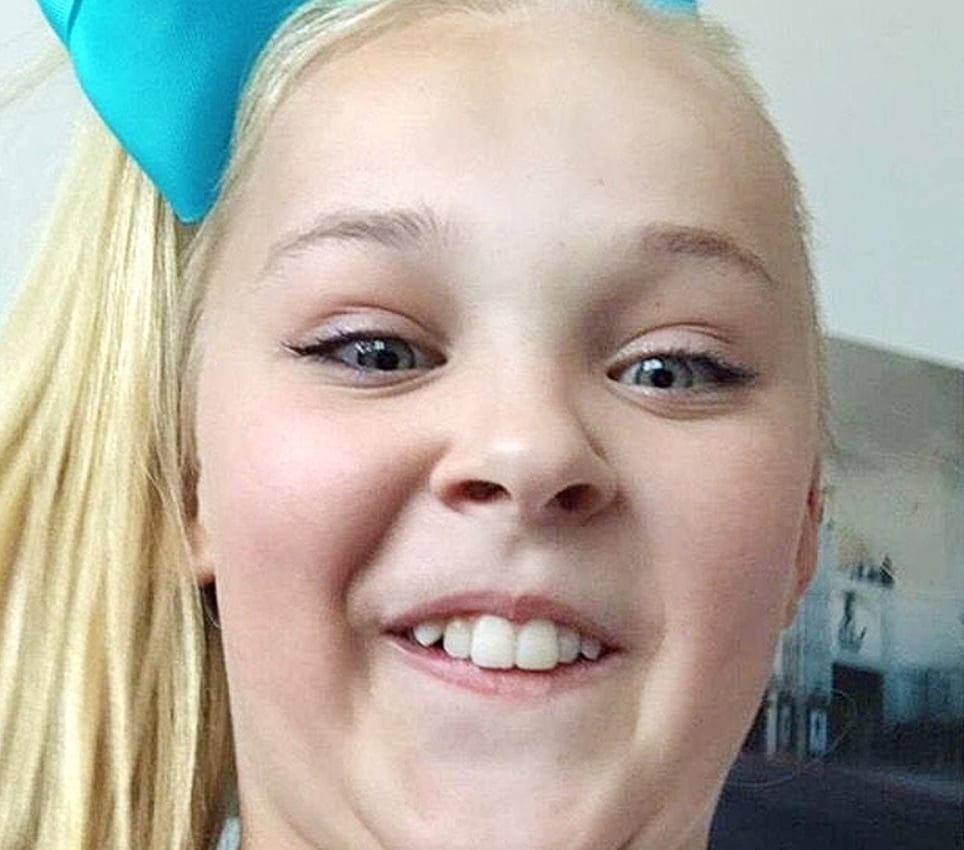 dientes de jojo siwa en 2015
