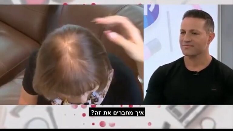 יחידת שיער
