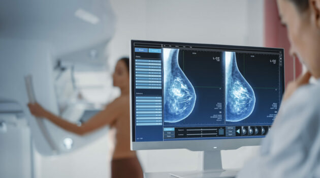 iCAD, GE HealthCare Integrate to Advance Breast Cancer Detection with AI