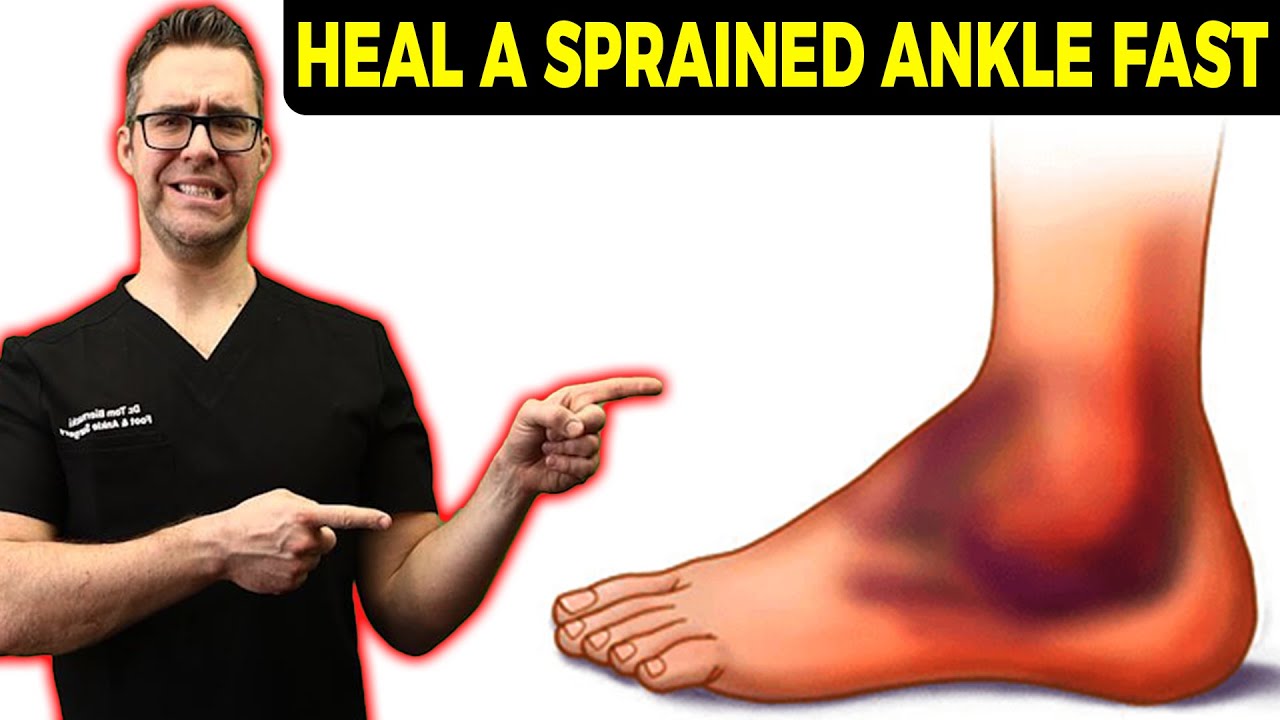 Fix TWISTED Ankle, ROLLED Ankle or SPRAINED Ankle Ligaments FASTER!