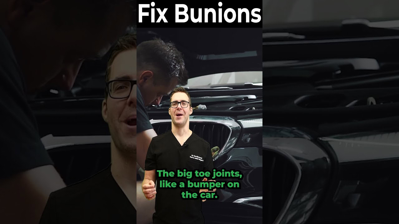 Best Shoes for Bunions? [How To Get Rid of Bunions]