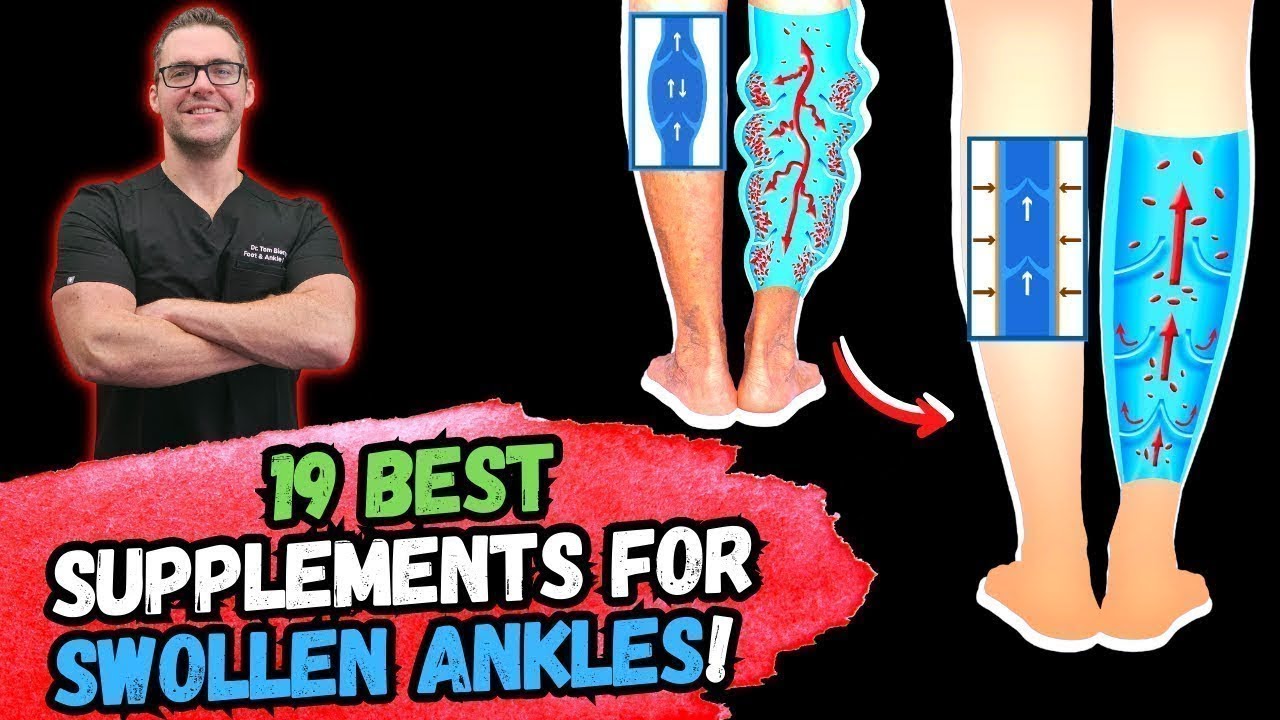 BEST 19 Supplements to FIX SWOLLEN Feet & Ankles! 2 Top 19 Supplements to INCREASE Blood Flow & Circulation!