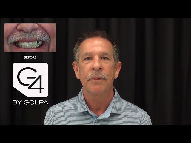 G4 By Golpa - Dallas - Patient: Rick E