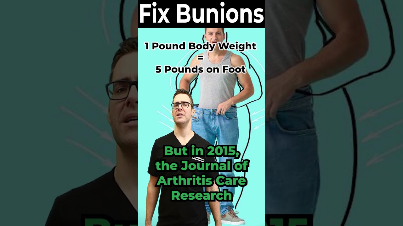 Big Toe Joint Pain Relief & Bunion Correction [Weight Loss Worth It?]