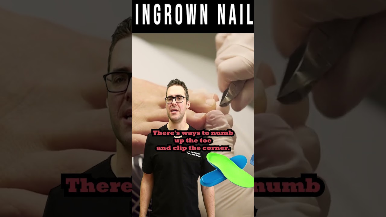 Ingrown Toenail Self Care & Home Treatment
