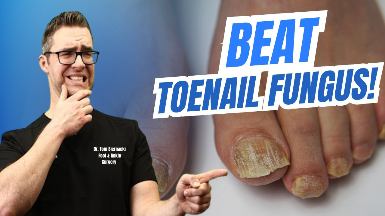 BEST Toenail Fungus Treatment 2024 [+4 BIG SECRETS]