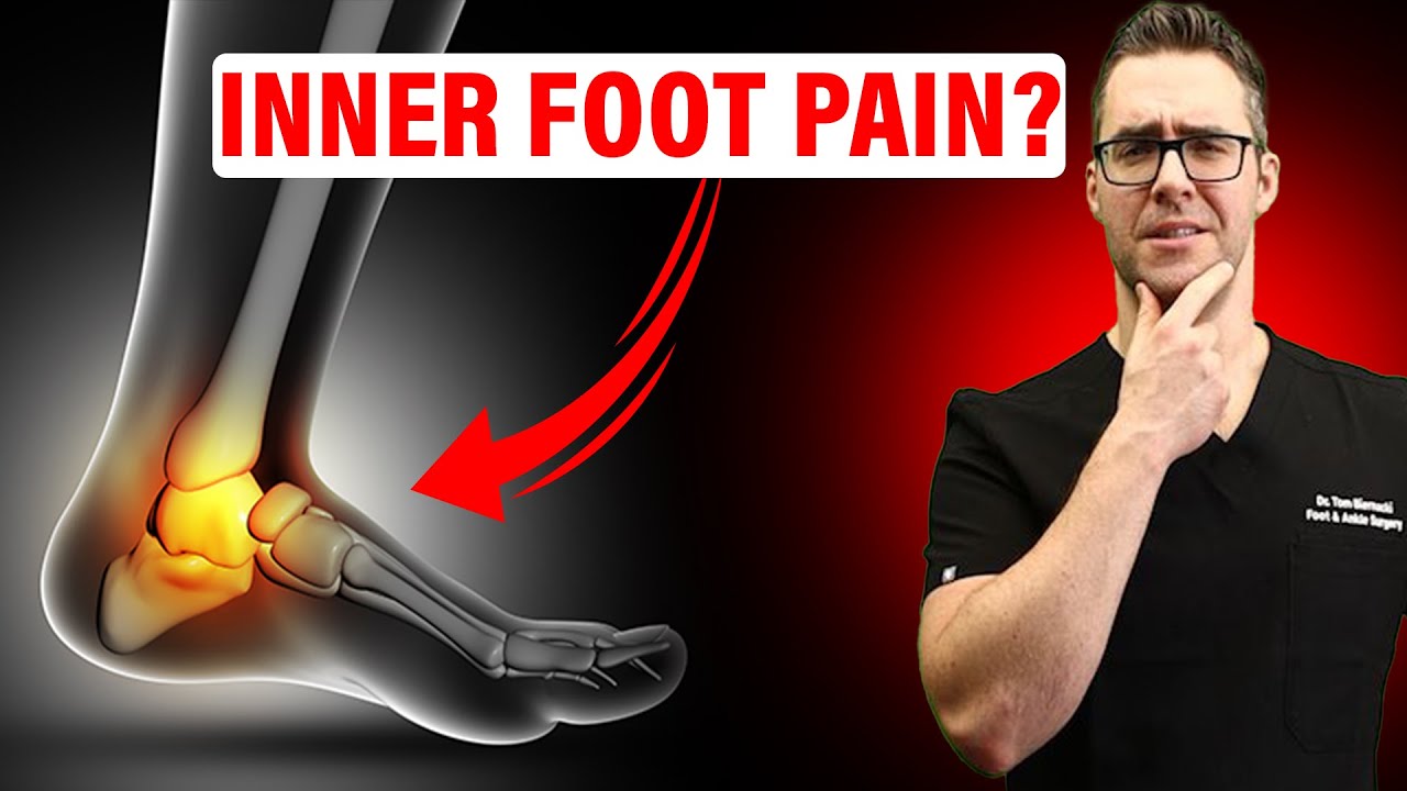 Posterior Tibial Tendonitis Treatment [FIX Inside of the Ankle Pain!]