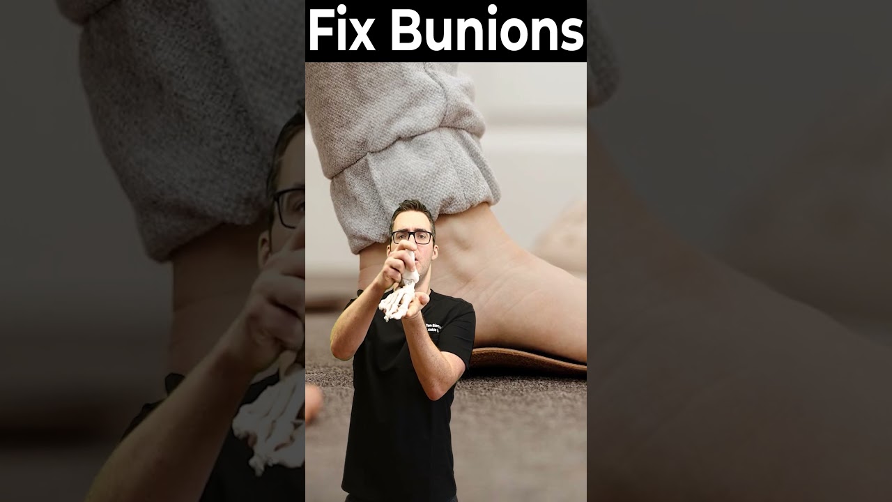 How To Get Rid of Bunions & BEST Bunion Corrector = ORTHOTICS! 2 How To Get Rid of Bunions & BEST Bunion Corrector = ORTHOTICS!