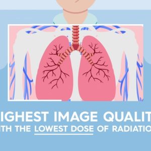 Изработка на анимирано explainer видео за pet ct скенер от acibadem клиники 8