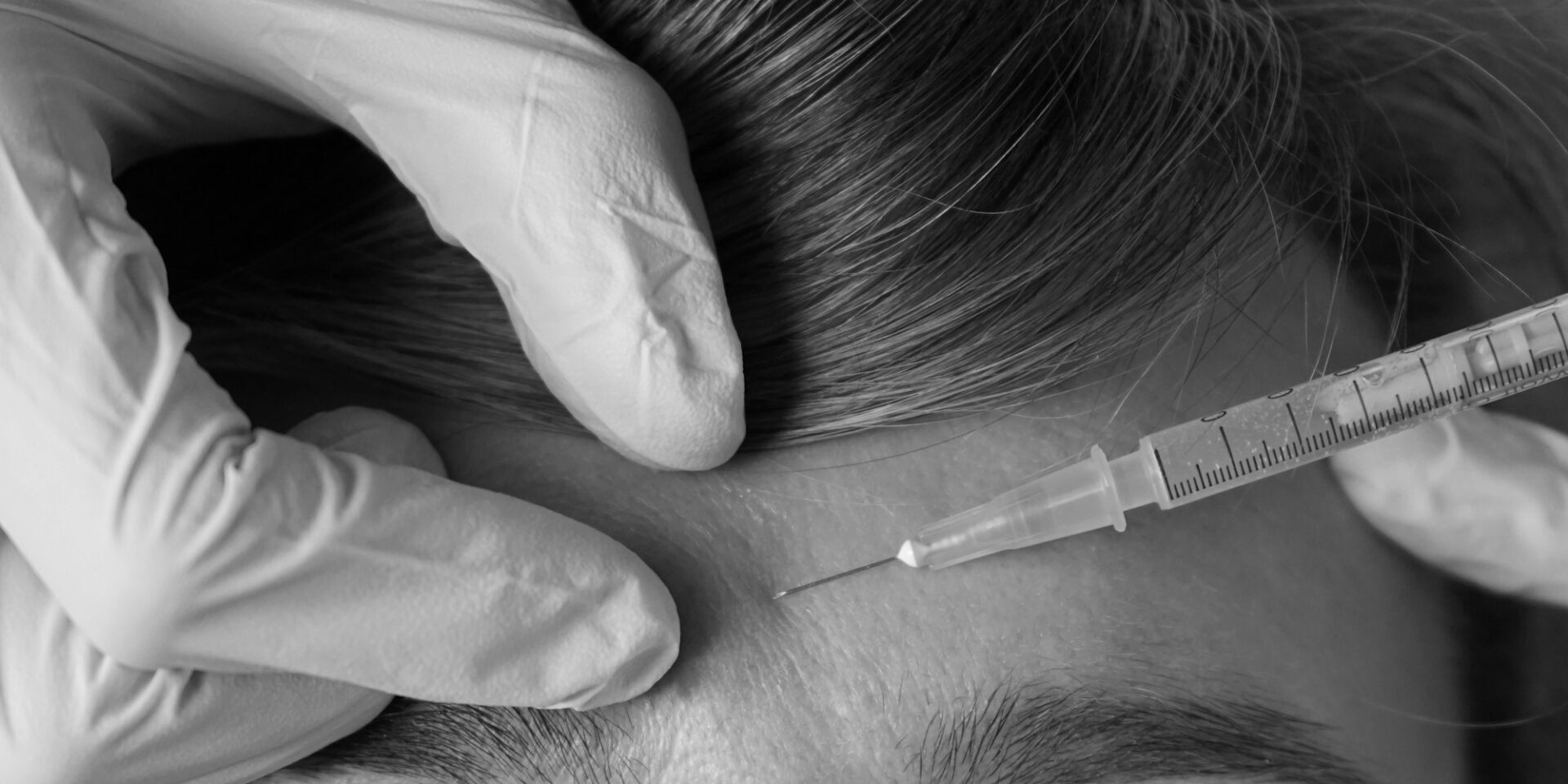 Botox injection in Meridian Boise Idaho