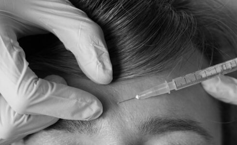 Botox injection in Meridian Boise Idaho