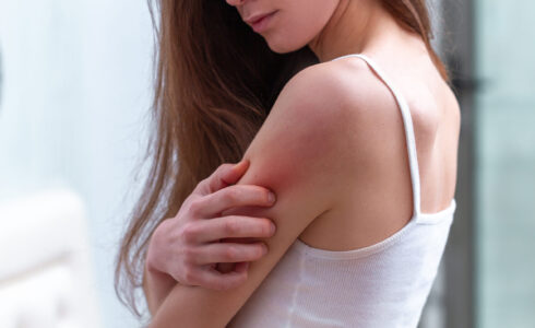 A person in a white tank top touches a red, irritated spot on their upper arm, possibly hinting at eczema. This may be rooted in imbalances within the gut microbiome.