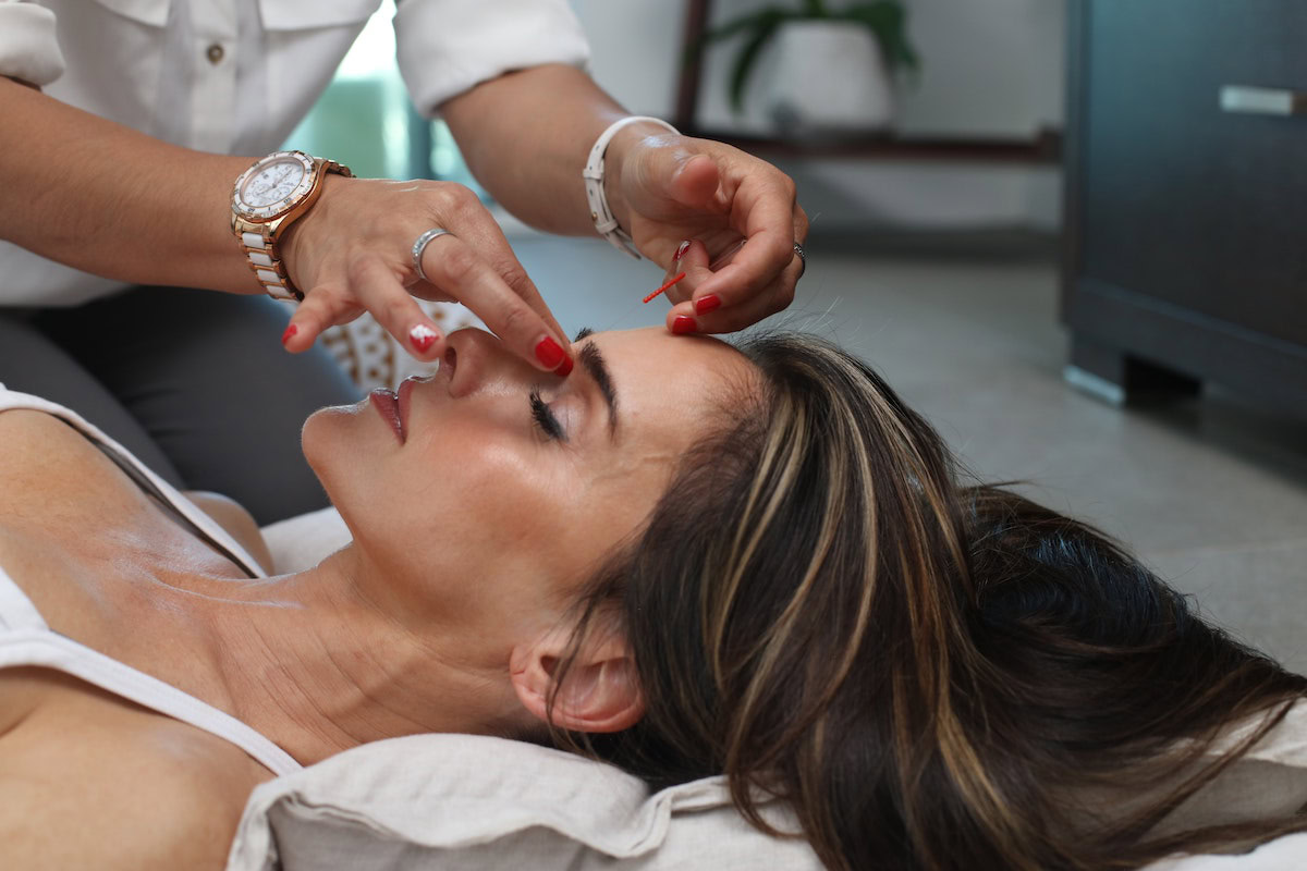 dry needling benefits