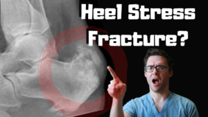 Calcaneal stress fracture 2 Calcaneal stress fracture Heel stress fracture treatment