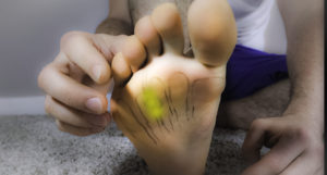 Mortons Neuroma Treatment 3 Feet Feel Like Socks are Bunched Up: Causes, Symptoms & Best Home Treatment!