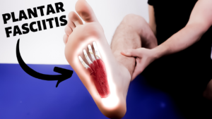 Chronic Pain In Feet 9 Foot Arch Pain: Causes, Symptoms & Best Treatment 2020