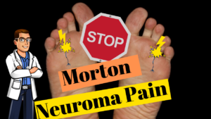 Mortons Neuroma Treatment 4 Morton Neuroma & Morton Neuralgia Pain