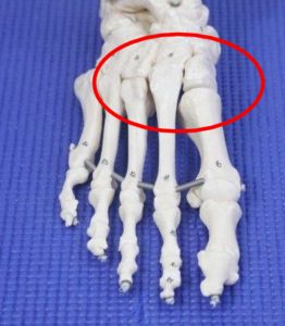 Bone Growth On Top of Foot 6 Bone Spur on top of the foot causes