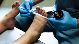 Mulders Click 3 Morton's Neuroma Cortisone Injection
