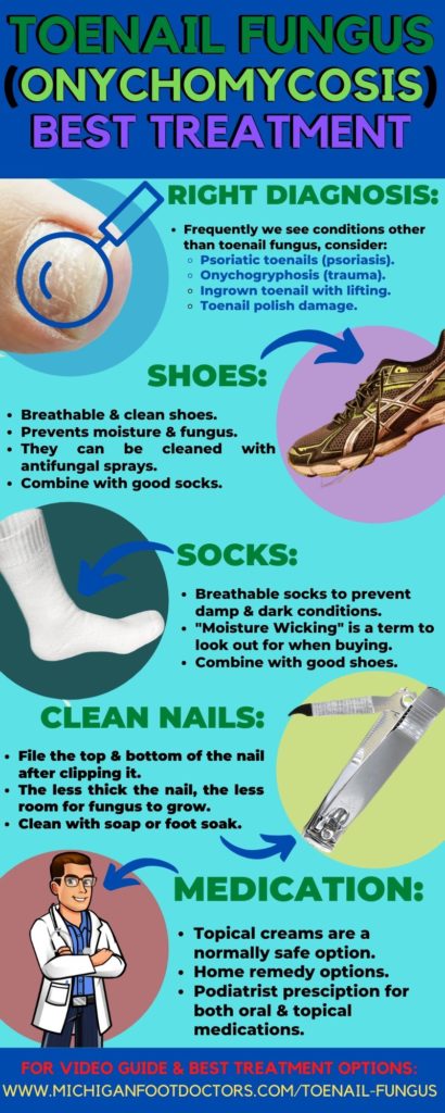 Onychocryptosis Symptoms Treatment 4 Superficial white onychomycosis toe nail fungus treatment