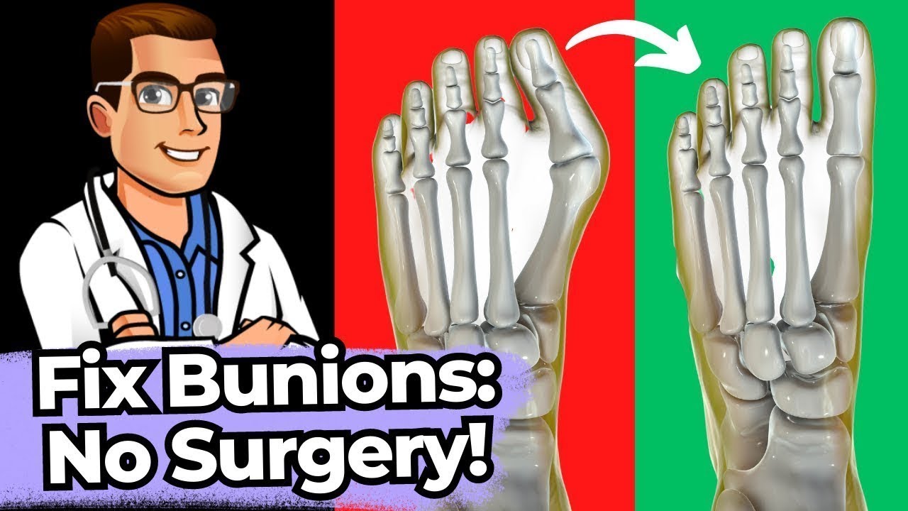 bunion surgery scar