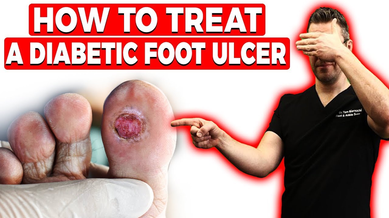 can you walk without a big toe