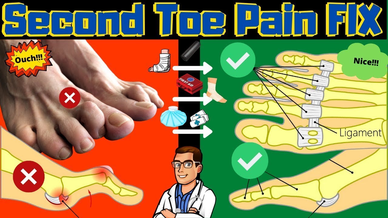 what causes toes to curl up