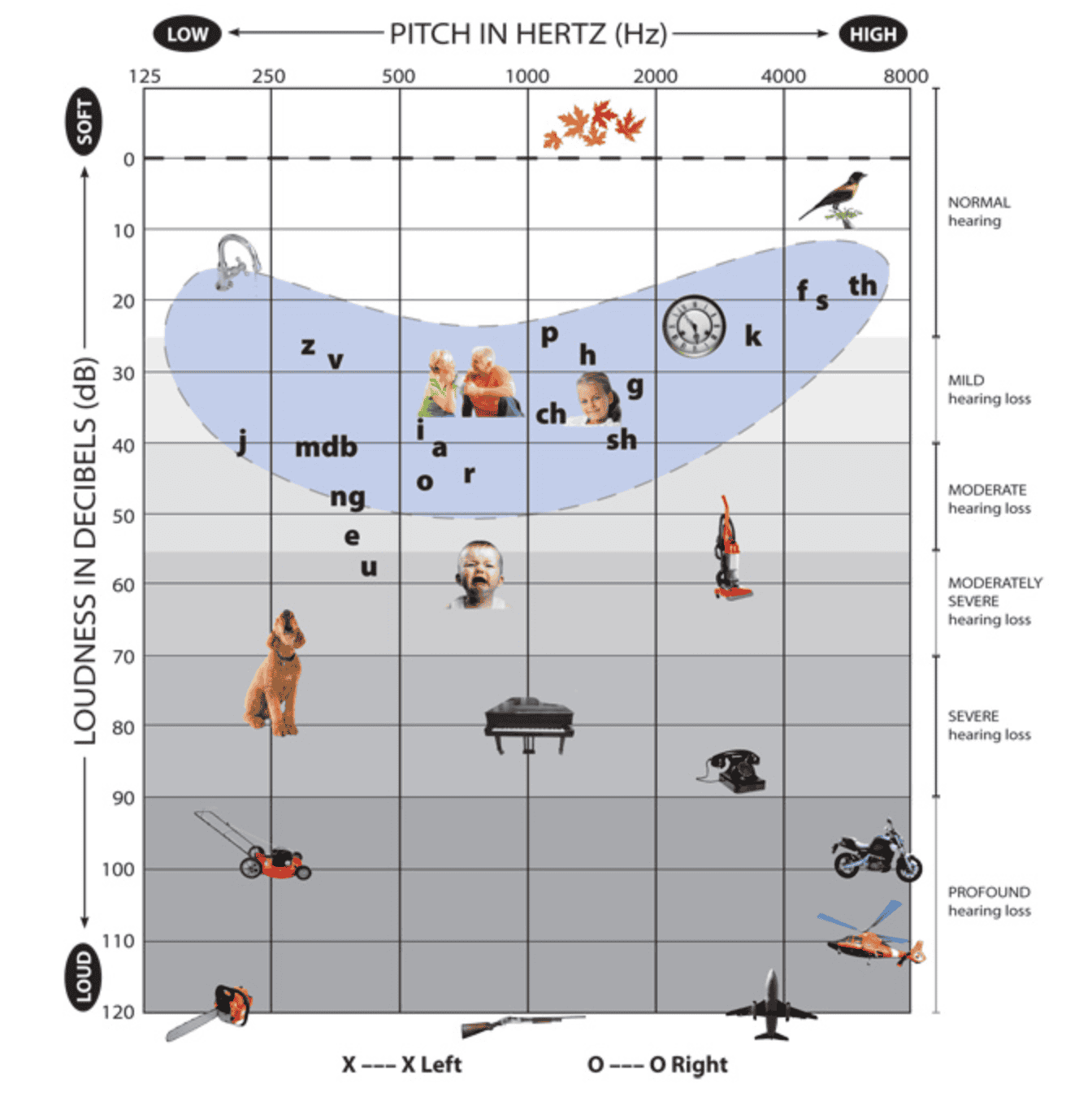 audiogram chart 