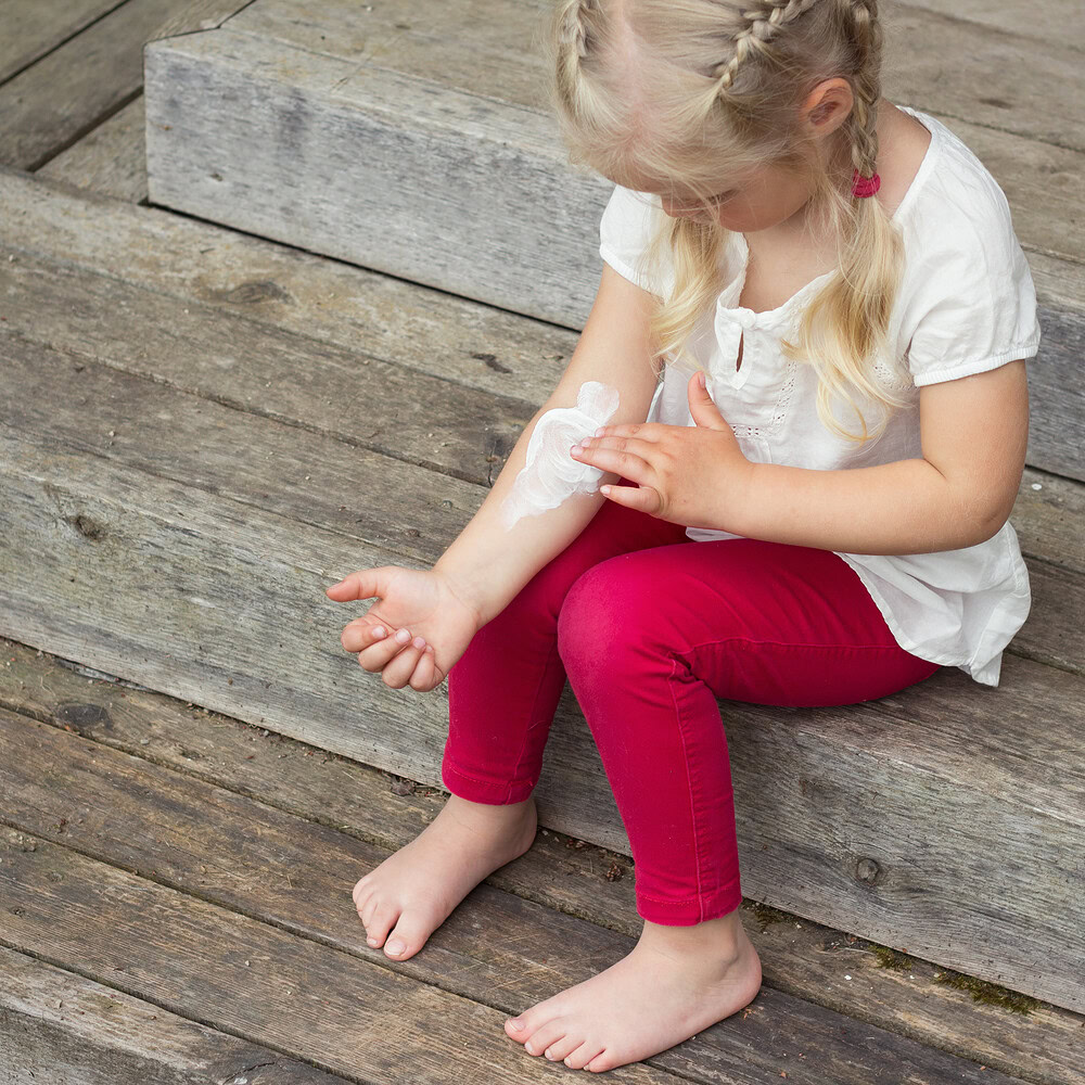 Relieving the symptoms of childhood eczema, naturally
