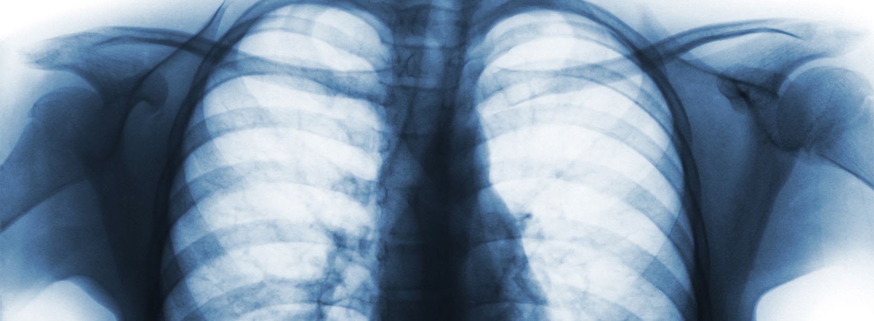 Learn to breathe before abdominal surgery