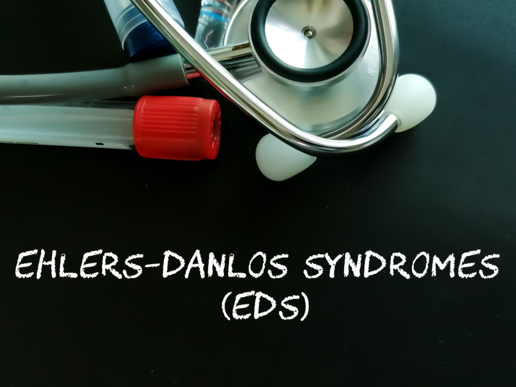 Ehlers-Danlos syndrome term on white background with stethoscope