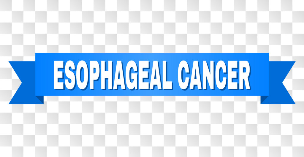 ESOPHAGEAL CANCER text on a ribbon. Designed with white caption and blue tape. Vector banner with ESOPHAGEAL CANCER tag on a transparent background.